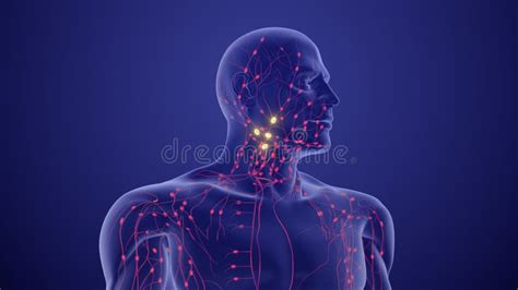 Medical Animation for Lymphoma Staging and Prognosis Stock Image - Image of doctor, illness ...