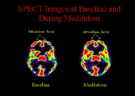 Pleasure Of Sex Vs Bliss Of Self In Brain Scans Advaita Vision