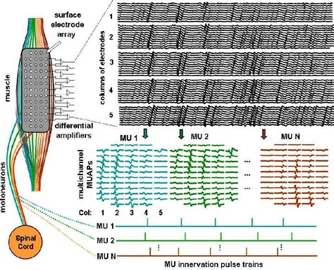 Figure From Two Dimensional High Density Surface Emg Hd Emg