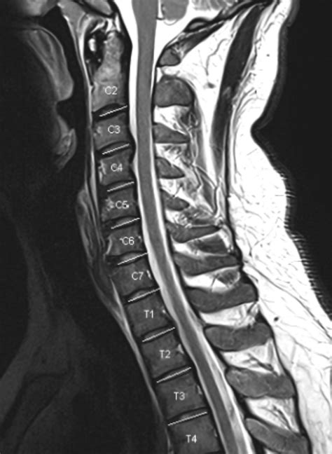 Magnetresonanztomografie Mrt Radiologie Filstal