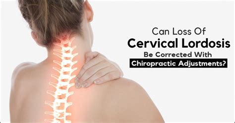 What Are Lumbar Disc Herniation And The Icd 10 Code