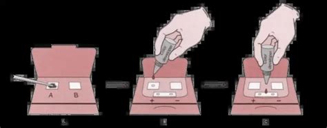 Fecal Occult Blood Test Well Explained Updated Version Laboratory