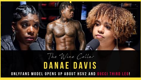 Viral Scandal Danae Davis Opens Up About Hsv2 Onlyfans And Gucci Third Leg The Porn Business