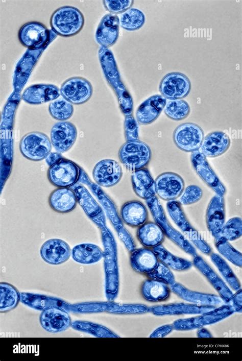 CANDIDA ALBICANS Stock Photo Alamy