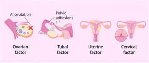 What Is In Vitro Fertilization Ivf Process Cost And Success Rates