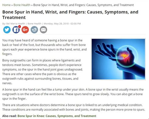 Bone Spur in Hand, Wrist, and Fingers: Causes, Symptoms, and Treatment ...