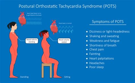 What Is "Syncope" & "Orthostatic Hypotension"? Syncope And Orthostatic ...