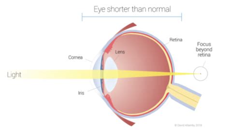 Neurophys Vision Flashcards Quizlet