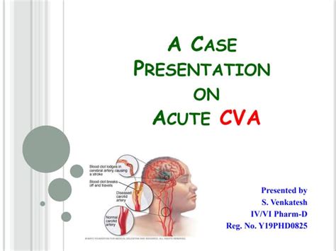 Case Presentation On Cvapptx