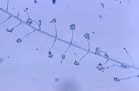 Sporothrix schenckii ~ Detailed Information | Photos | Videos