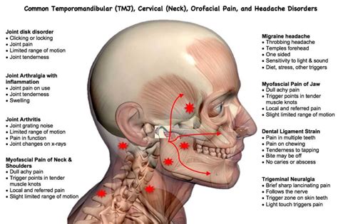 Treatment For Jaw Pain TMJ Pain