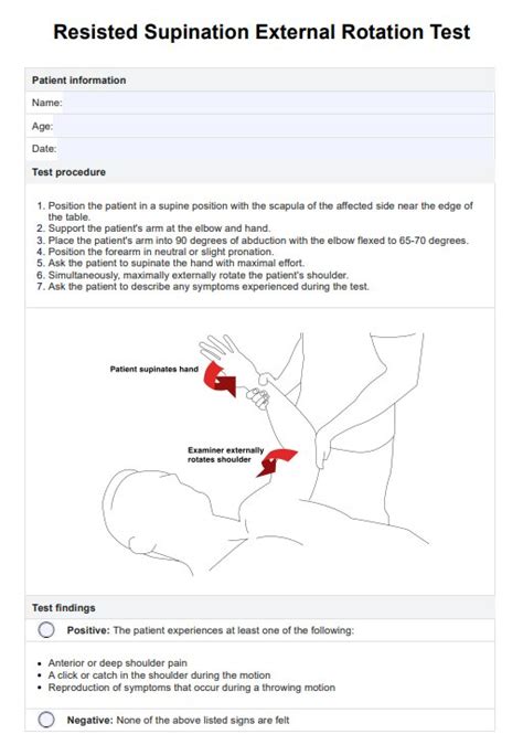 Perrla Eye Exam And Example Free Pdf Download