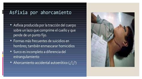 Asfixia Por Ahorcamiento Y Estrangulamiento Ppt