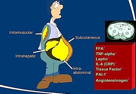 Fat Topography Of Diabetes Type 2 Subjects Download Scientific Diagram