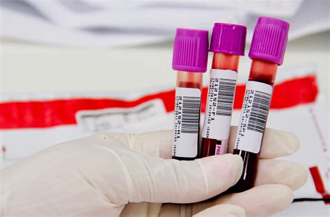 Exame De Sangue Tipos De Check Up E Tempo De Jejum