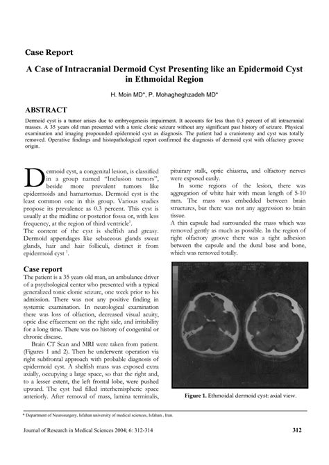 Pdf A Case Of Intracranial Dermoid Cyst Presenting Like An Epidermoid