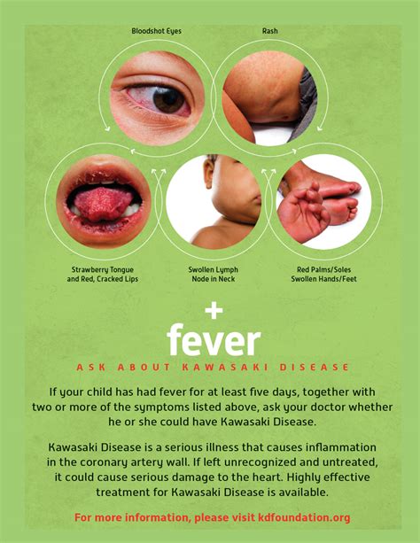 Kawasaki Disease Signs