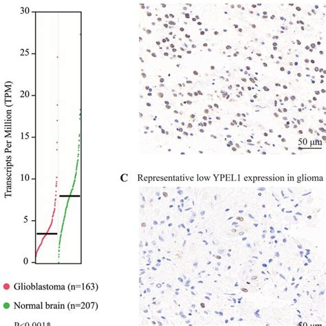 Expression Of Ypel In Gliomas A Mrna Levels Of Ypel In Glioma