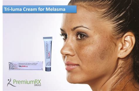 Tri Luma Cream For Melasma For Reviews Premiumrx Online Pharmacy