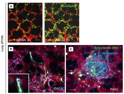 Frontiers Intravital Imaging Of Pulmonary Immune Response In Inflammation And Infection