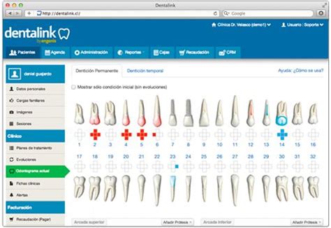 Odontograma Inicial Dentalinksoftwaredental Es Fácil De Usar Fácil De Aprender Desde