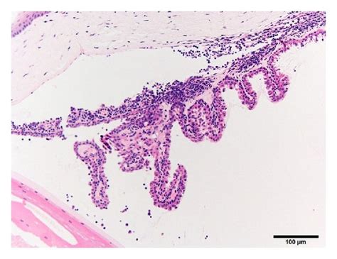 Photomicrograph of the ciliary body/iris of the eye from a 50-week-old ...