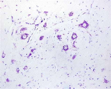 Spinal Cord. Motor Neurons of Anterior Horn Stock Photo - Image of motor, spinal: 319017666