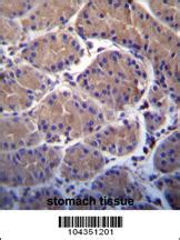 Anti USP20 Rabbit Polyclonal Antibody VWR