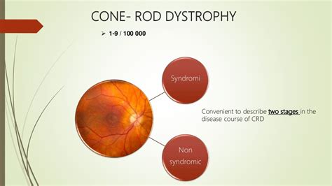 Cone and Rod Dystrophy