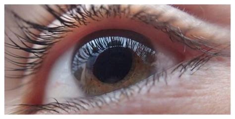 Technique to regenerate optic nerve a possible future glaucoma treatment -- Science & Technology ...