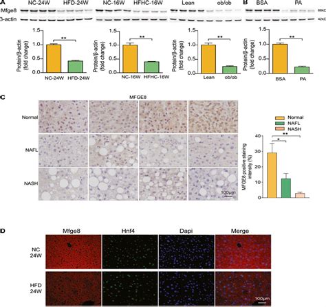 Milk Fat Globule Epidermal Growth Factor Factor 8 Improves H Hepatology