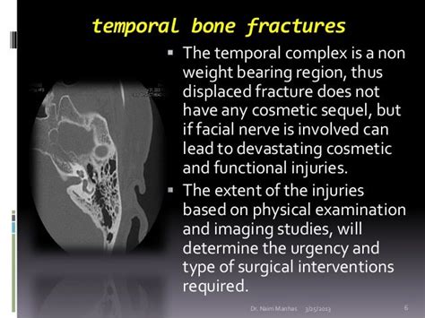 Temporal Bone Fracture Longitudinal Vs Transverse