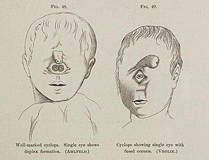 Cyclopia - Wikipedia