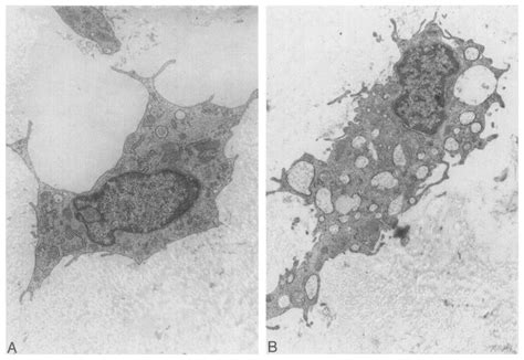 A Electron Microscope Picture Of Myofibroblasts In Fresh Semilunar