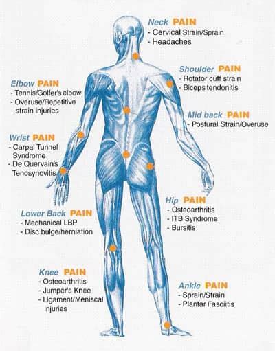 Understanding Nerve Pain | Days To Fitness