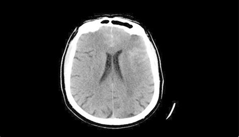 Imagenología De La Cabeza Y El Cerebro Concise Medical Knowledge