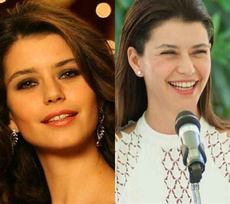 Beren Saat in Dişleri Magazin Gündemini Salladı Oyuncu Ön Dişlerini