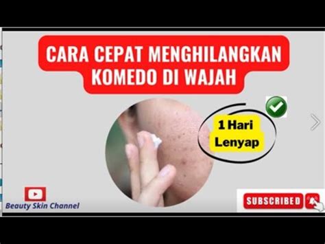 Hilangkan Komedo Di Wajah Ini Dia Caranya Sangat Mudah YouTube