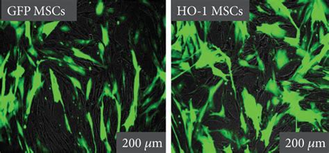 HO 1 And GFP Gene Transfection In Ad MSCs A Representation Of The