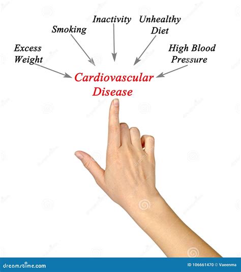 Causes To Cardiovascular Disease Stock Photo - Image of virtual, finger ...