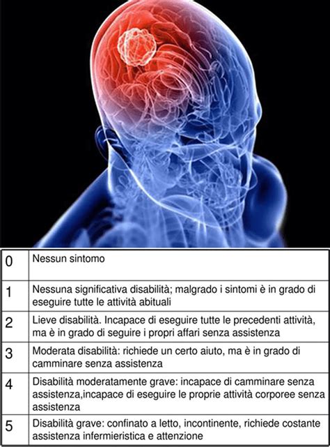 Le Scale Di Valutazione Glasgow Coma Score Cincinnati Prehospital