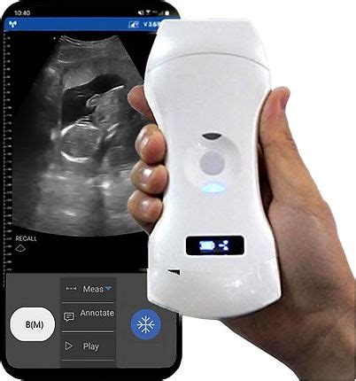 Handheld Ultrasound - Ultra Imaging Solutions