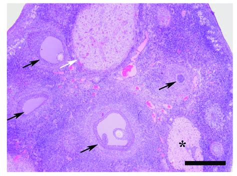 Corpus Luteum And Corpus Albicans Histology