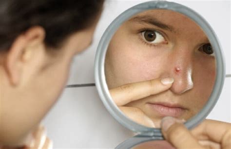 How To Get Rid Of Pimple In Nose 16 Natural Remedies