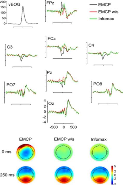 Figure From Detection Of Brain Tumor In Eeg Signals Using Independent