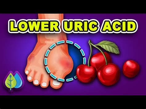 10 Ways To Lower Uric Acid Naturally