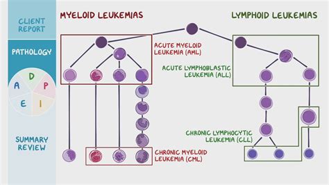 Leukemia: Nursing process (ADPIE) - Osmosis Video Library