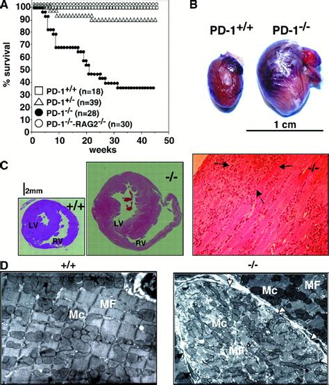 Autoimmune Dilated Cardiomyopathy In PD 1 Receptor Deficient Mice Science