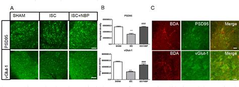 Figure 1 From Dl 3 N Butylphthalide Promotes Neuroplasticity And Motor