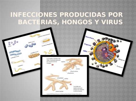 Pptx Infecciones Producidas Por Bacterias Hongos Y Virus Dokumen Tips